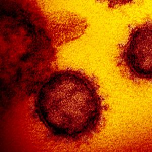 H5N1 Bird Flu
