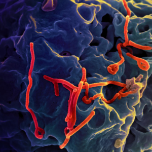 Ebola