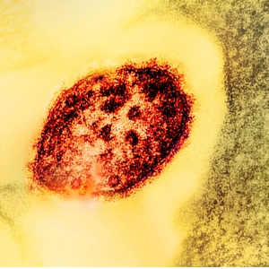 H5N1 Bird Flu